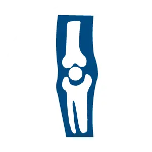 phau-thuat-keo-dai-chan