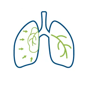 chan-thuong-chinh-hinh