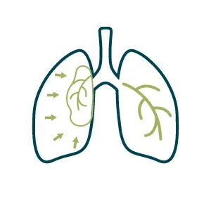 chan-thuong-chinh-hinh