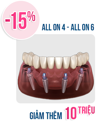 Khuyến mãi nha khoa tháng 10