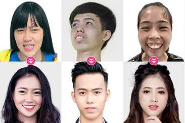 khách hàng phẫu thuật thẩm mỹ