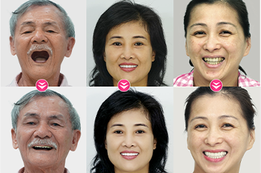 khách hàng phẫu thuật thẩm mỹ