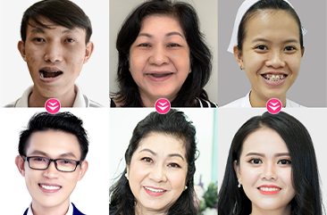 khách hàng phẫu thuật thẩm mỹ