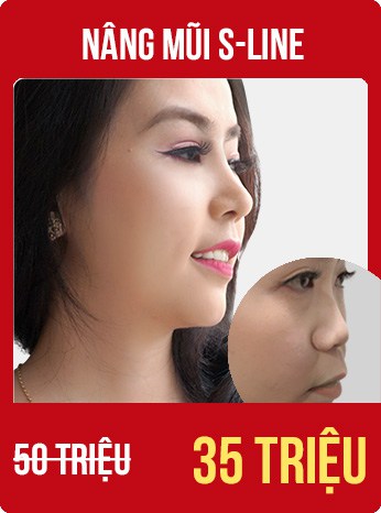 bùng nổ siêu sale tháng 8