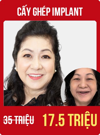 bùng nổ siêu sale tháng 8