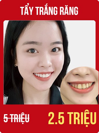 bùng nổ siêu sale tháng 8