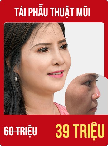 bùng nổ siêu sale tháng 8