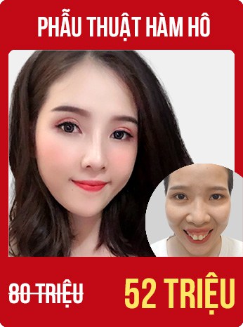 bùng nổ siêu sale tháng 8