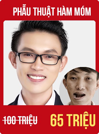 bùng nổ siêu sale tháng 8