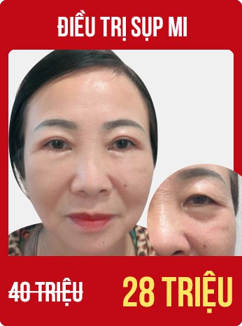 bùng nổ siêu sale tháng 8