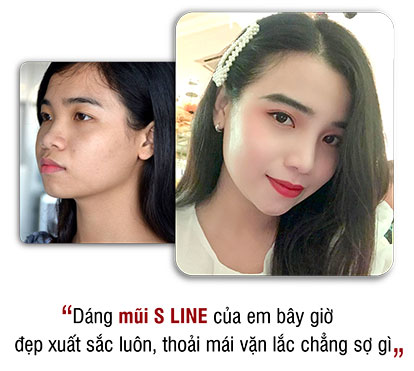 khách hàng phẫu thuật thẩm mỹ