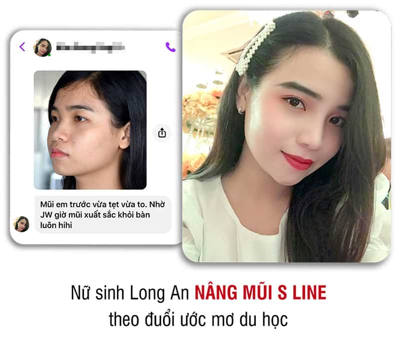 khách hàng phẫu thuật thẩm mỹ