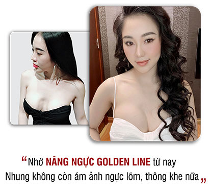 khách hàng phẫu thuật thẩm mỹ