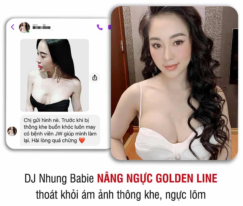 khách hàng phẫu thuật thẩm mỹ