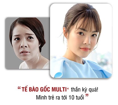 khách hàng phẫu thuật thẩm mỹ