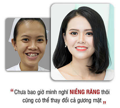 khách hàng phẫu thuật thẩm mỹ