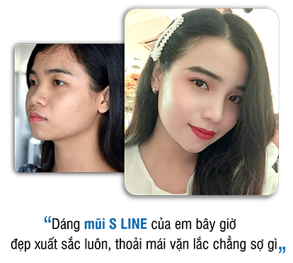 khách hàng phẫu thuật thẩm mỹ