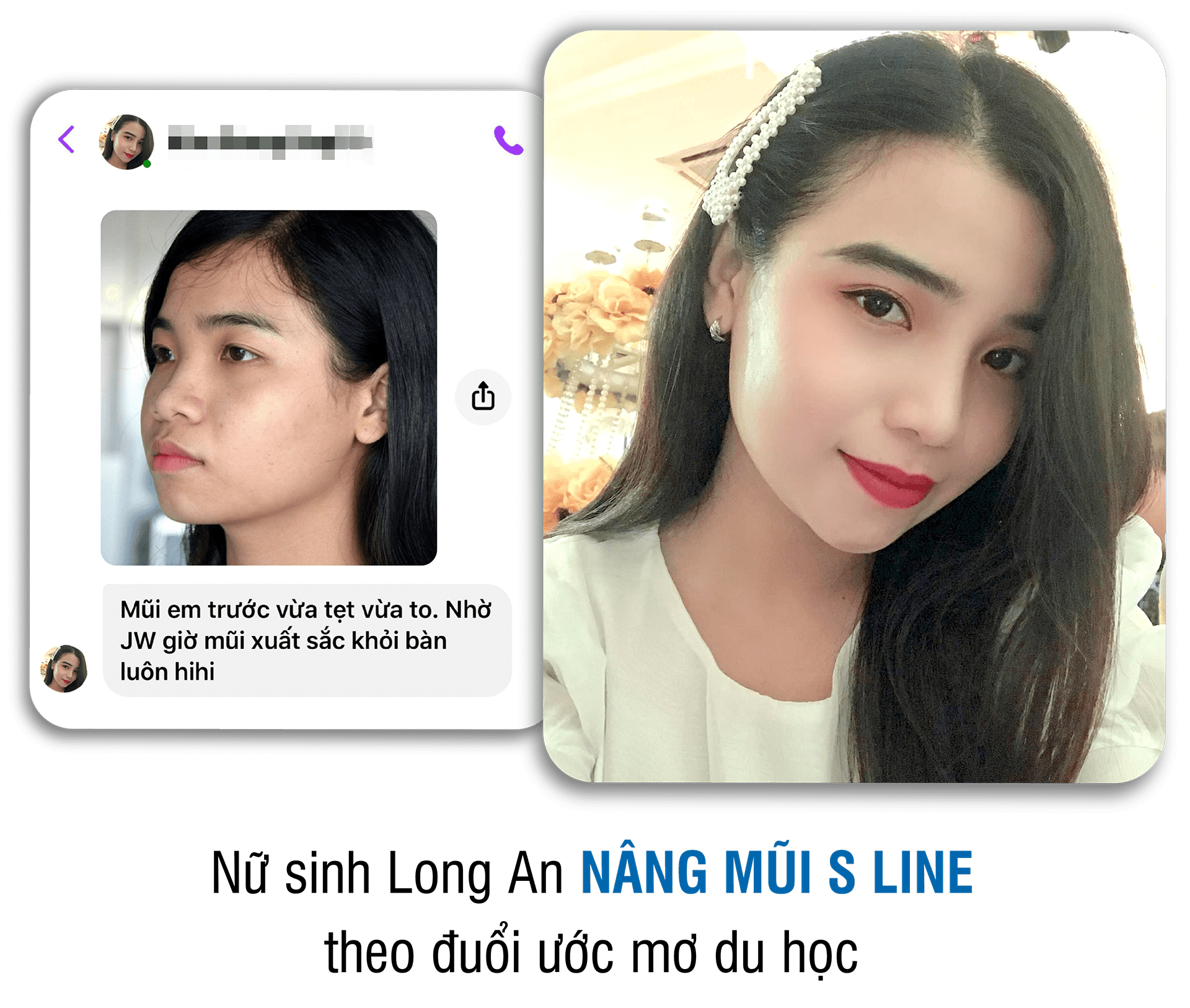 khách hàng phẫu thuật thẩm mỹ