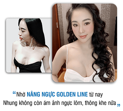 khách hàng phẫu thuật thẩm mỹ