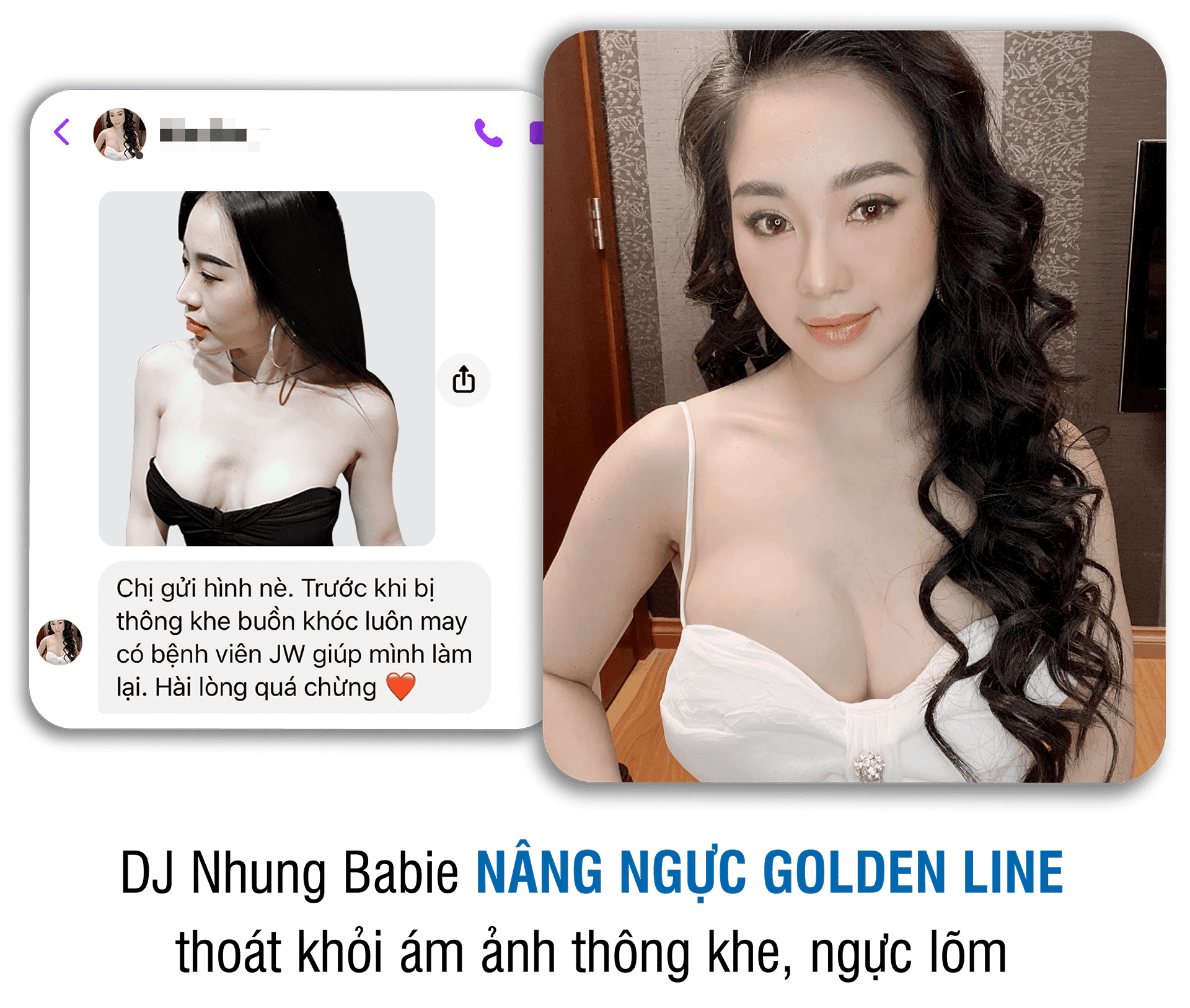 khách hàng phẫu thuật thẩm mỹ