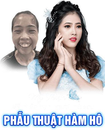 khách hàng phẫu thuật thẩm mỹ