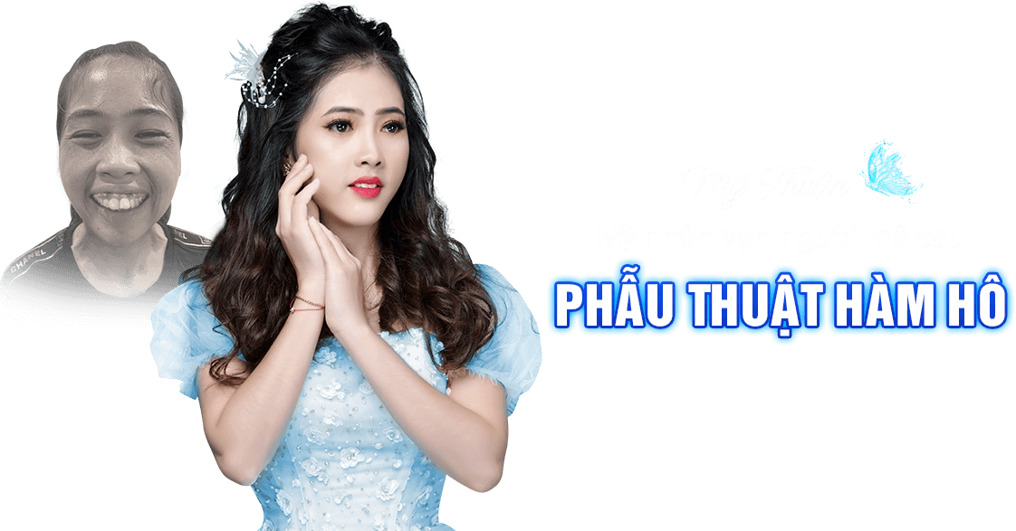 khách hàng phẫu thuật thẩm mỹ