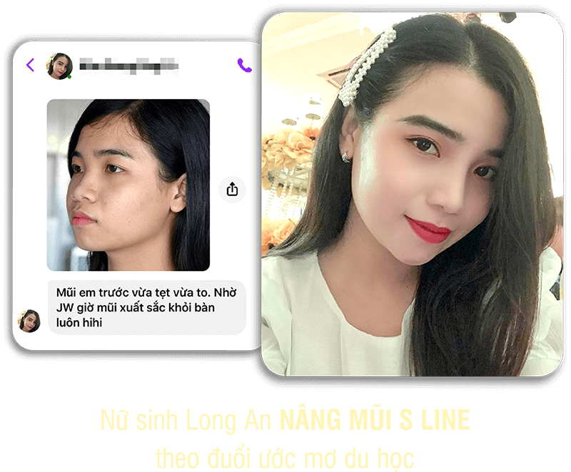 khách hàng phẫu thuật thẩm mỹ