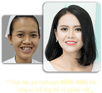 khách hàng phẫu thuật thẩm mỹ