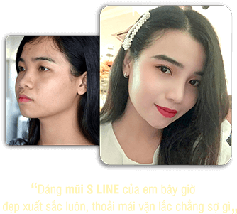 khách hàng phẫu thuật thẩm mỹ