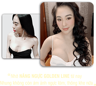 khách hàng phẫu thuật thẩm mỹ