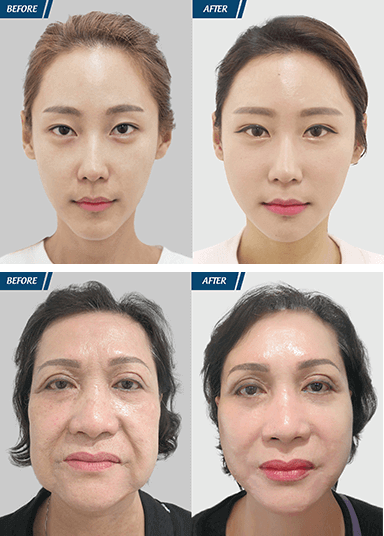 Cải Lão Hoàn Đồng