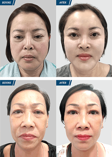 Cải Lão Hoàn Đồng