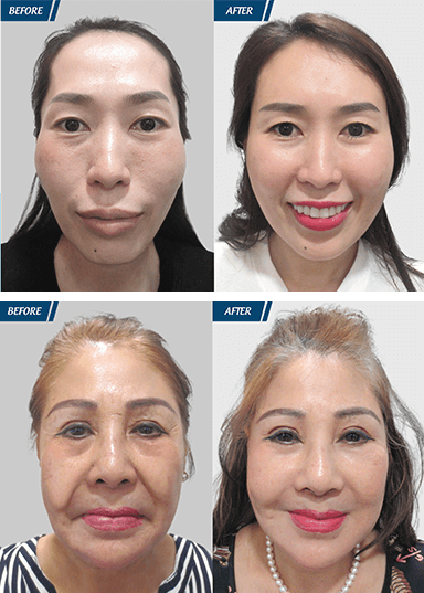 Cải Lão Hoàn Đồng