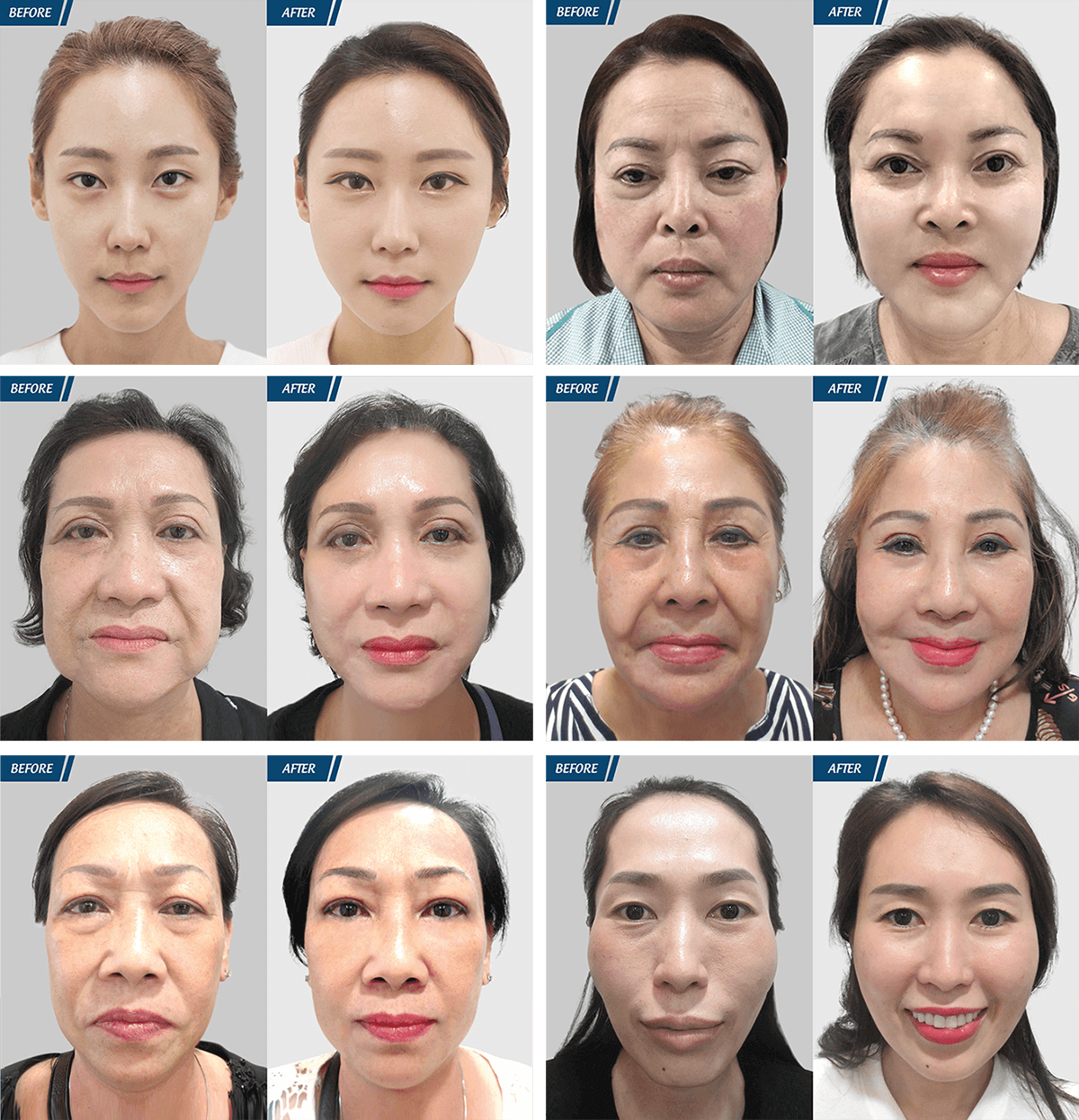 Cải Lão Hoàn Đồng