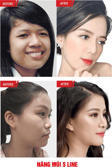 Đại Hội Thẩm Mỹ