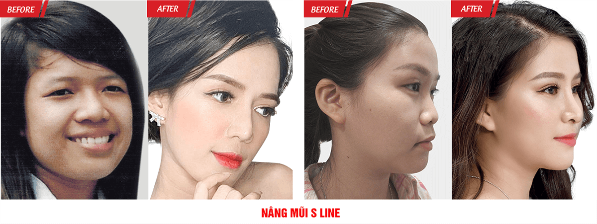 Đại Hội Thẩm Mỹ