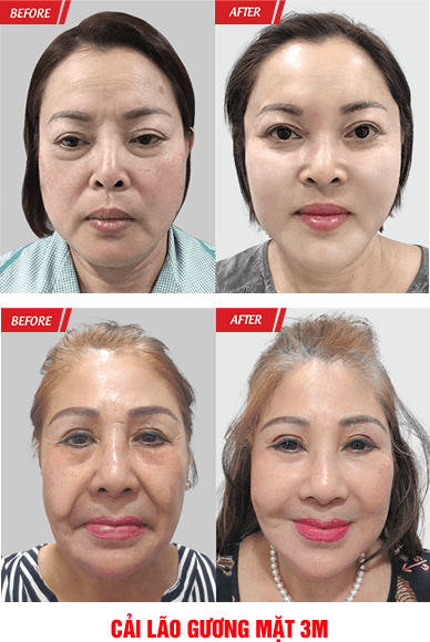 Đại Hội Thẩm Mỹ