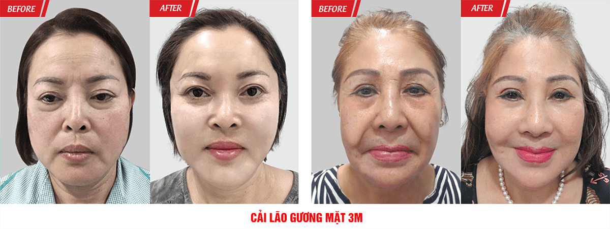 Đại Hội Thẩm Mỹ