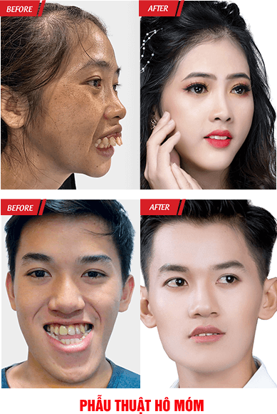 Đại Hội Thẩm Mỹ