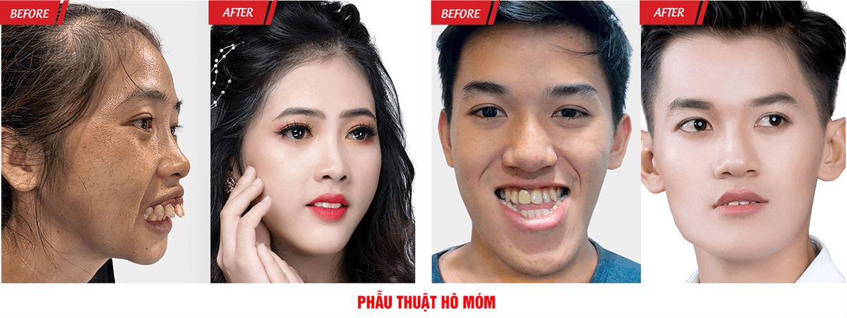 Đại Hội Thẩm Mỹ