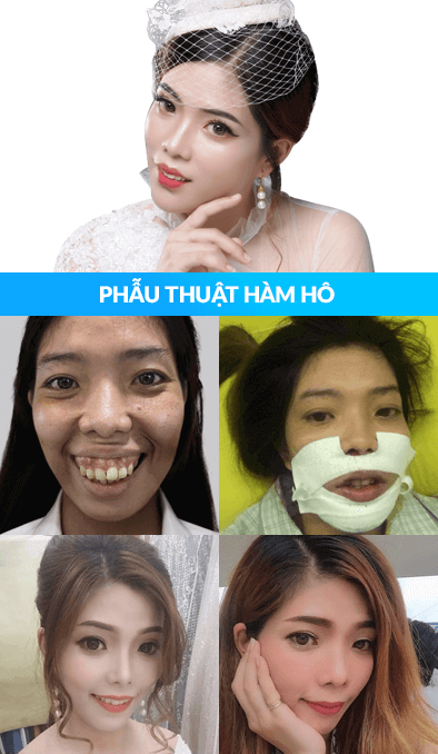 JW 22 Tuổi - Sinh Nhật Tri Ân