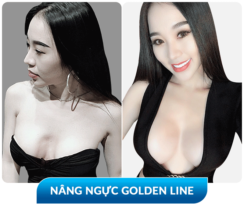 khách hàng phẫu thuật thẩm mỹ