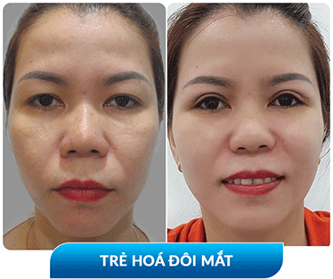 khách hàng phẫu thuật thẩm mỹ