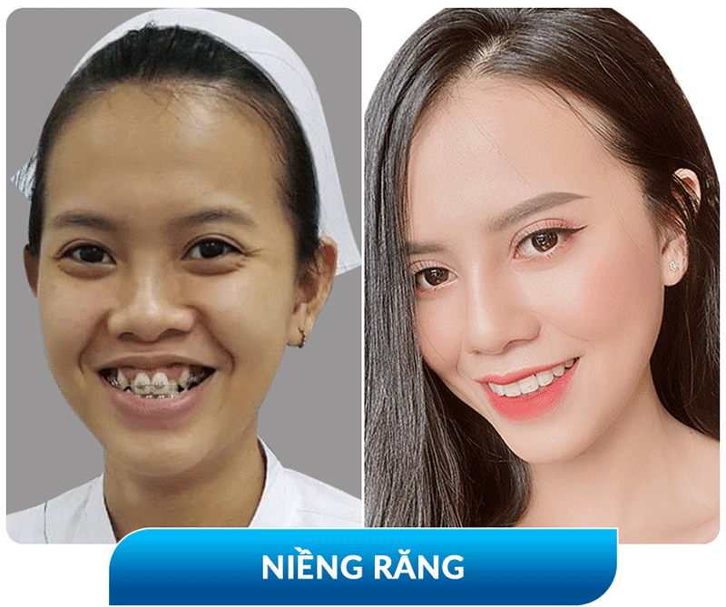 khách hàng phẫu thuật thẩm mỹ