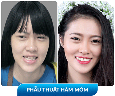 khách hàng phẫu thuật thẩm mỹ