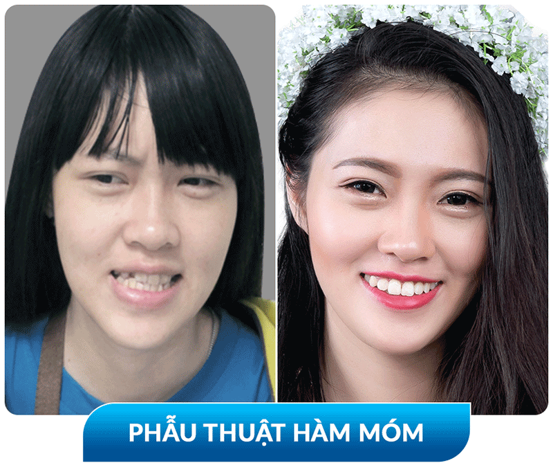 khách hàng phẫu thuật thẩm mỹ