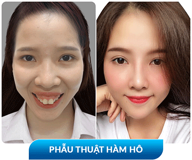 khách hàng phẫu thuật thẩm mỹ