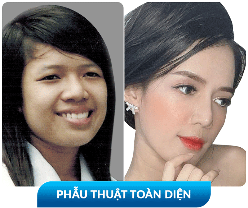 khách hàng phẫu thuật thẩm mỹ