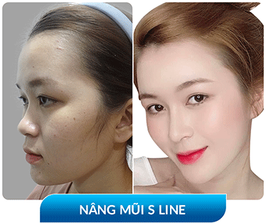 khách hàng phẫu thuật thẩm mỹ