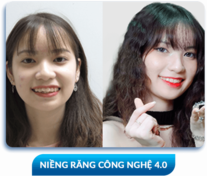 khách hàng phẫu thuật thẩm mỹ